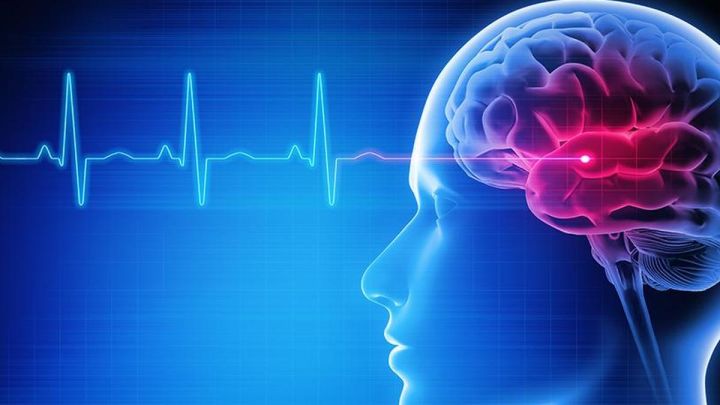 KMCRI Hubbali Tackles Stroke Surge with Hub-and-Spoke Care Model